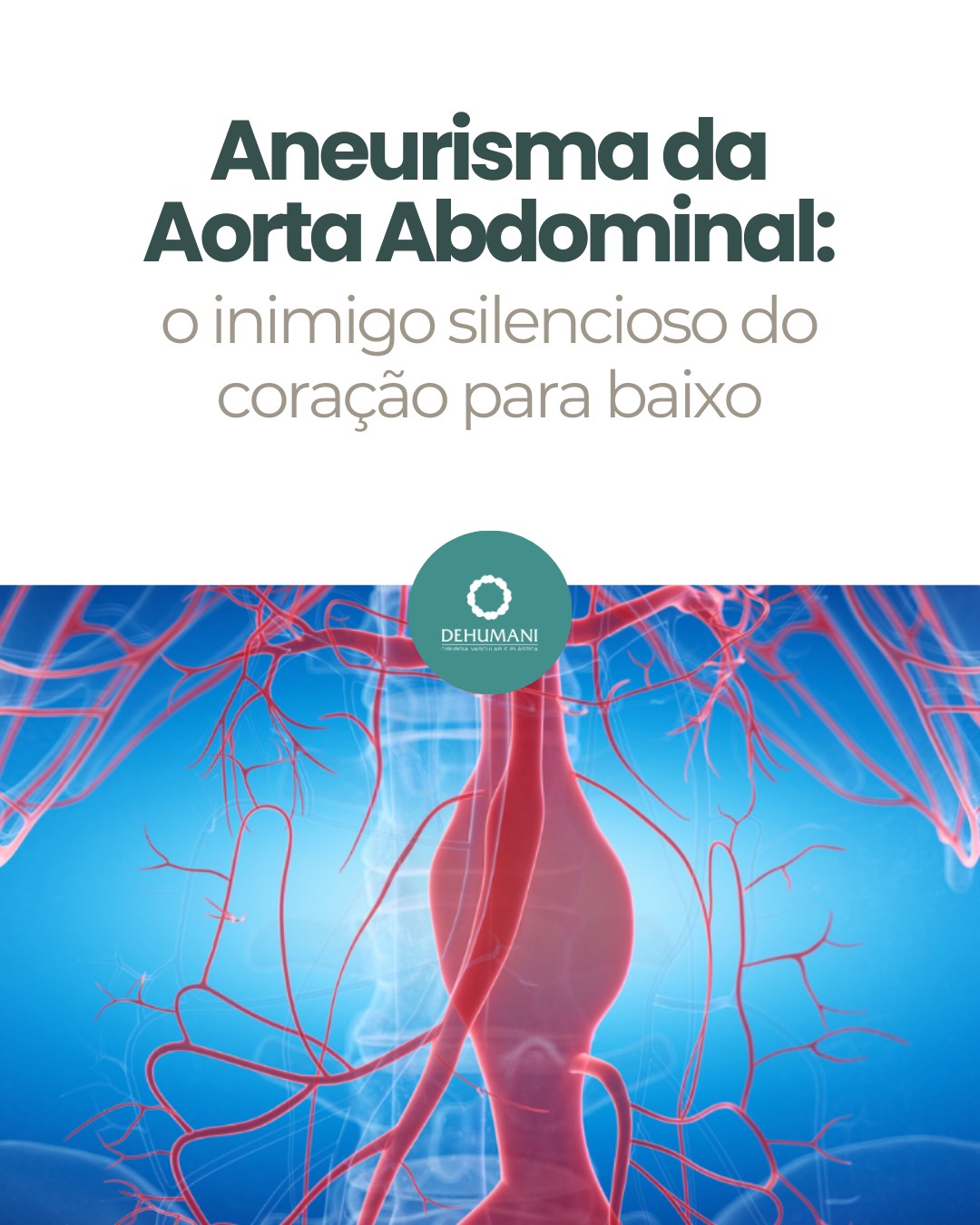 Clinica - ⚠️ O aneurisma da aorta abdominal é uma dilatação anormal da ...