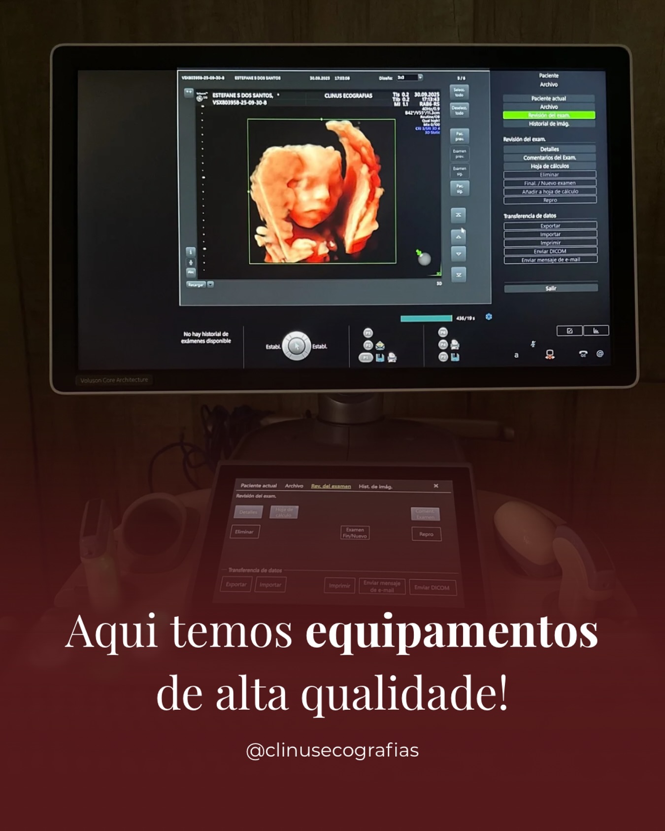 Clinus Ecografias | Rio Grande RS