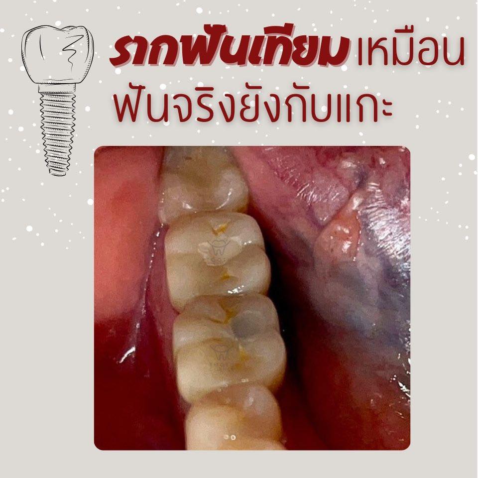Tooth Corner Clinic - ทูธคอร์เนอะ สหคลินิก | Lam Luk Ka