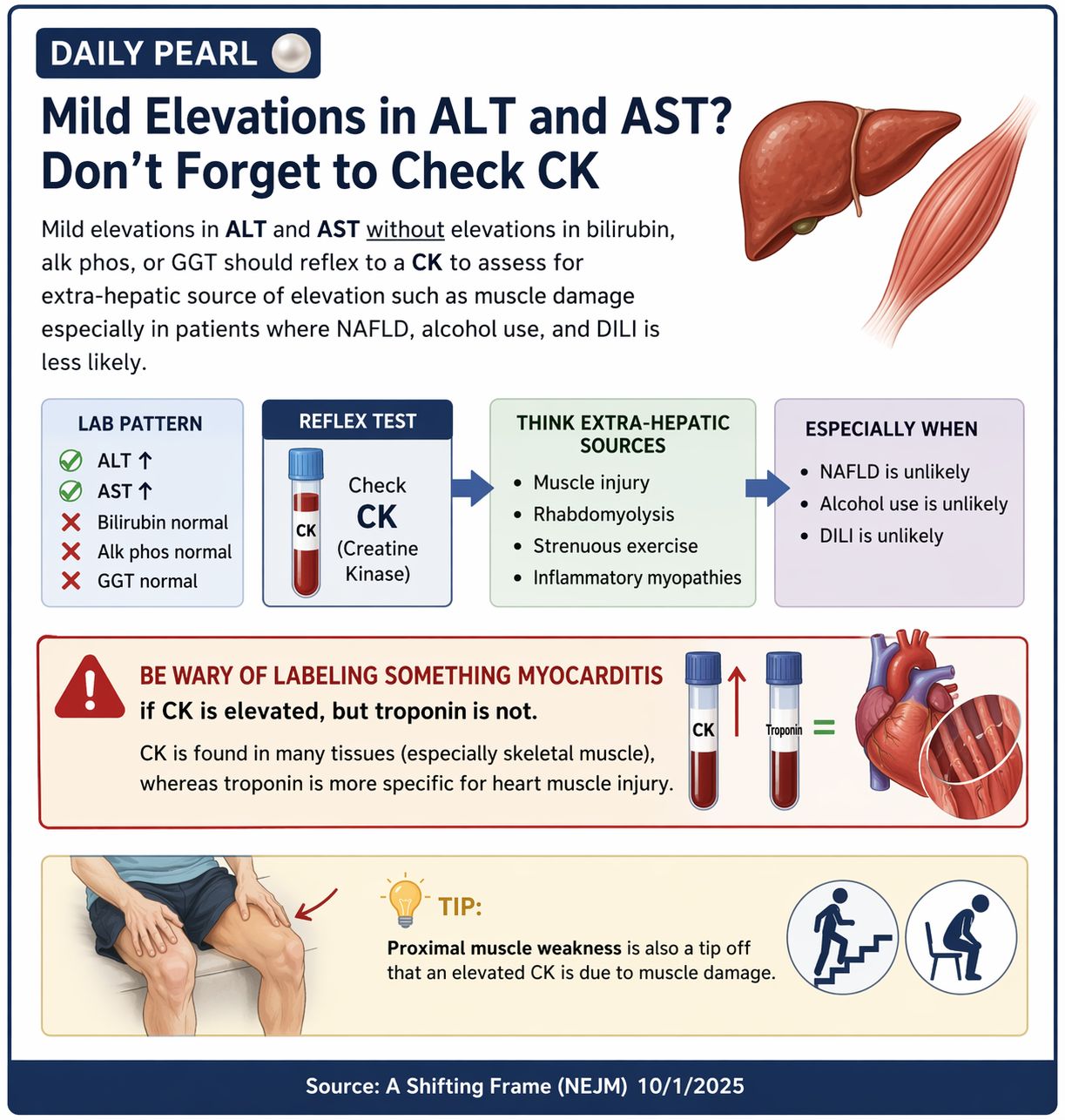 CK levels elevated 5-50 times above normal