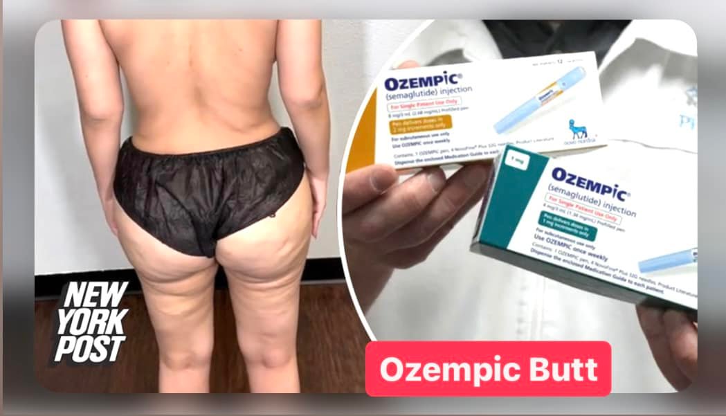 semaglutide cellulite Avéli Treatment | Cellulite Reduction Pinellas Med Clinic
