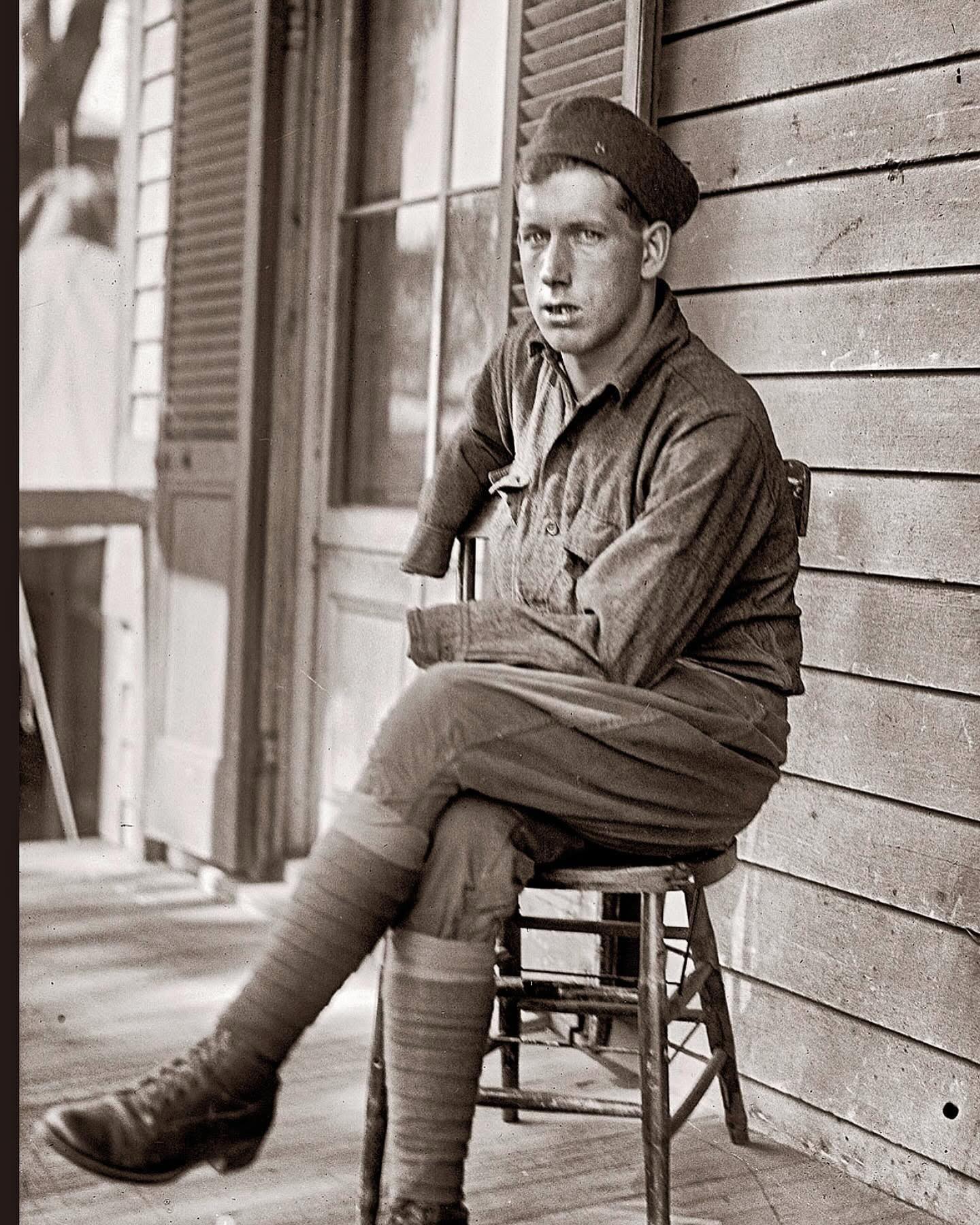 Scott - An armless soldier convalescing at Walter Reed Hospital in 1918 ...