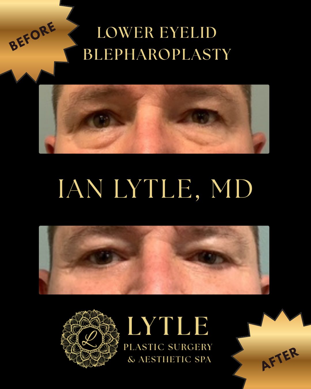 Lytle Plastic Surgery | Plymouth MI