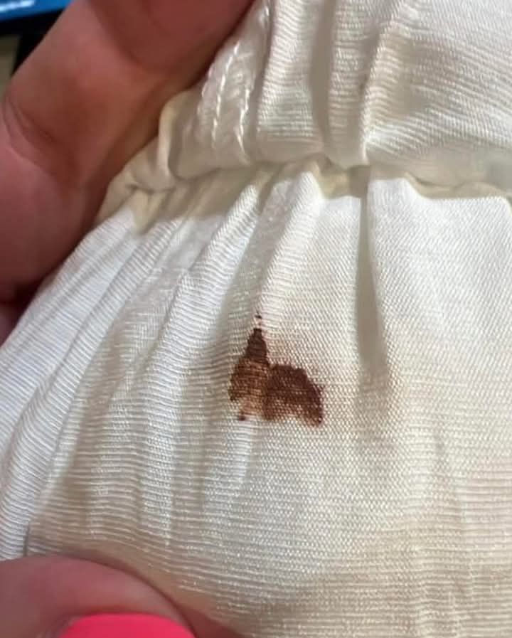 How to remove unknown brown stain from wedding dress?