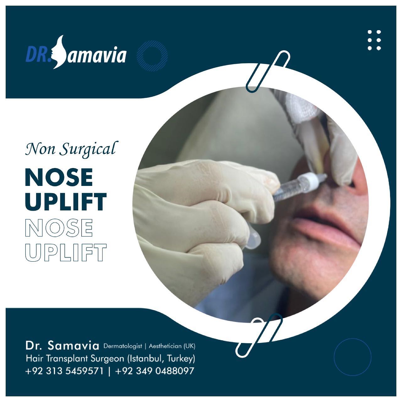 Dr. Samavia - Benefits of a nonsurgical rhinoplasty 👃: *No... | Facebook