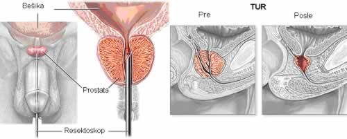 Uroloska Ordinacija Dr Orkina Elena Facebook