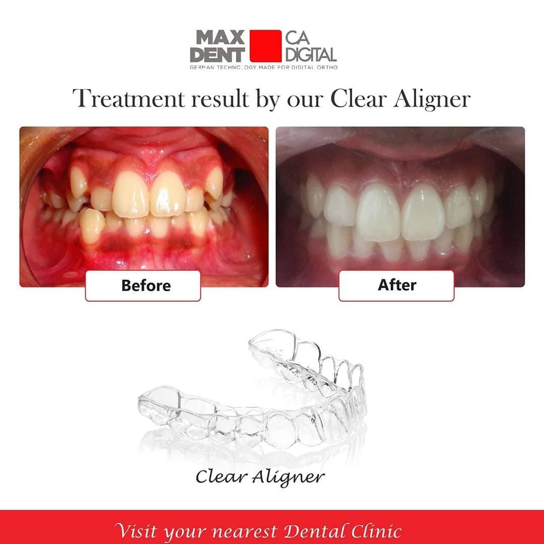 BNI - MAX DENT ORTHO 🦷Manufacturers of Dental supplies ▫Dental