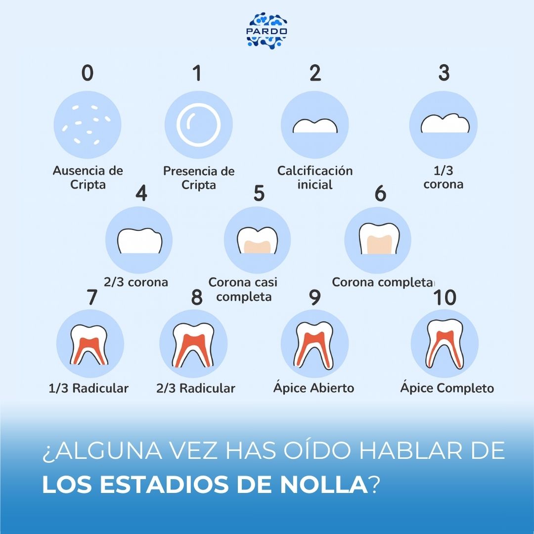 Instituto - 🦷 ¿Alguna vez has oído hablar de los estadios de Nolla ...