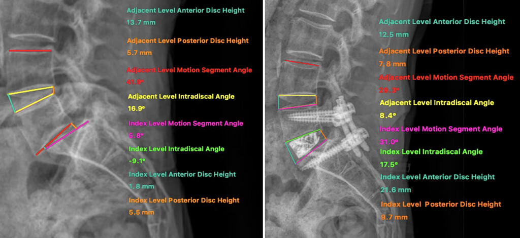 Journal - #OnlineFirst: Does segmental alignment matter? A novel ...