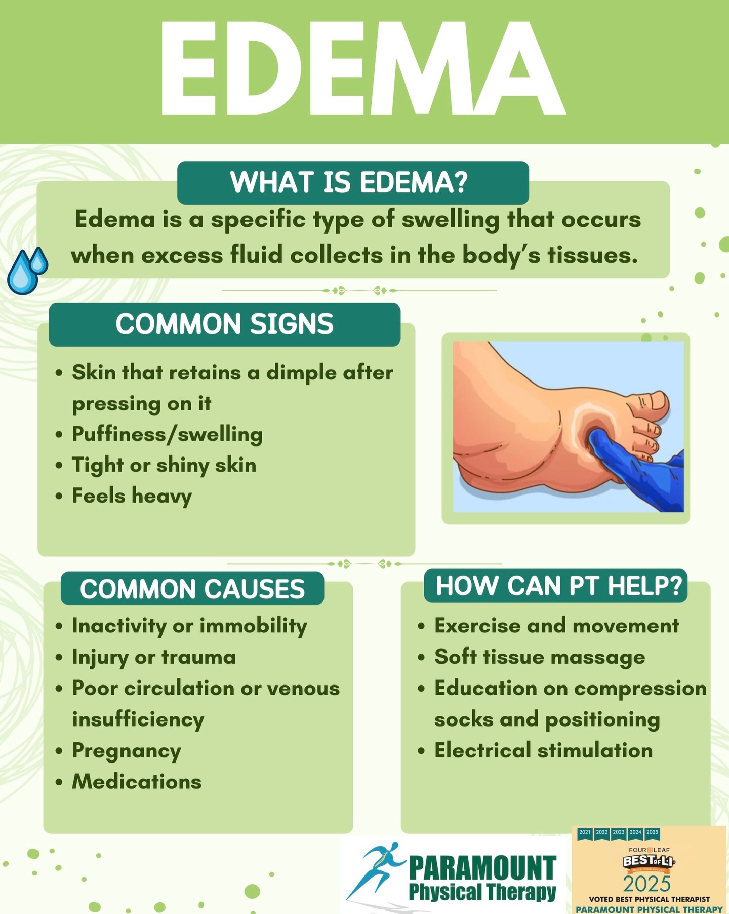 What Is Edema? Edema is a... - Paramount Physical Therapy | Facebook