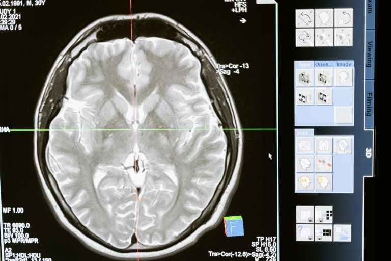 b12 injections parkinson& 39 Does anyone take Vit for Parkinsons? CYANOCOBALAMIN INJECTION, USP 30000