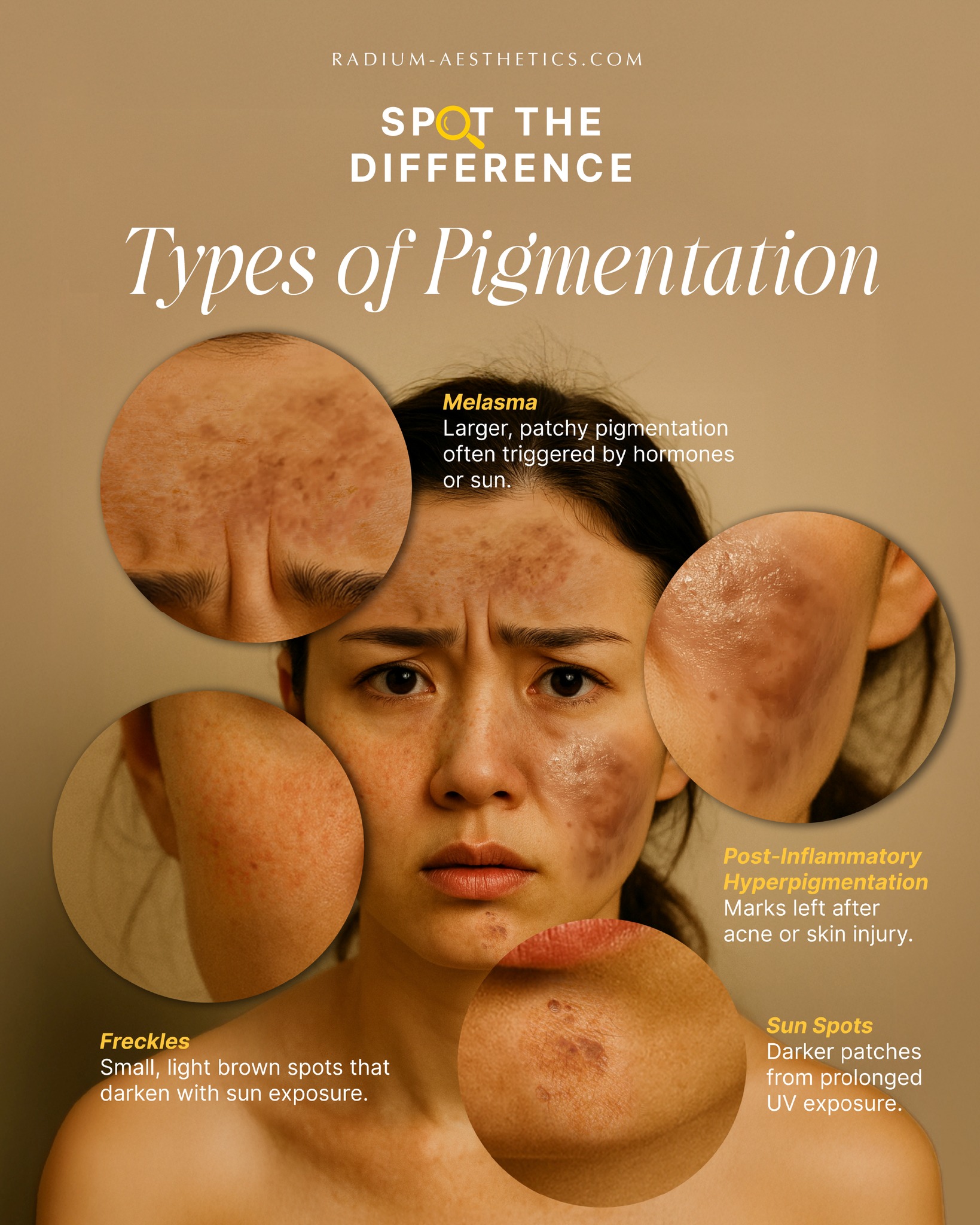 Radium - 🔍 SPOT THE DIFFERENCE — TYPES OF PIGMENTATION 🎯 Can you spot ...