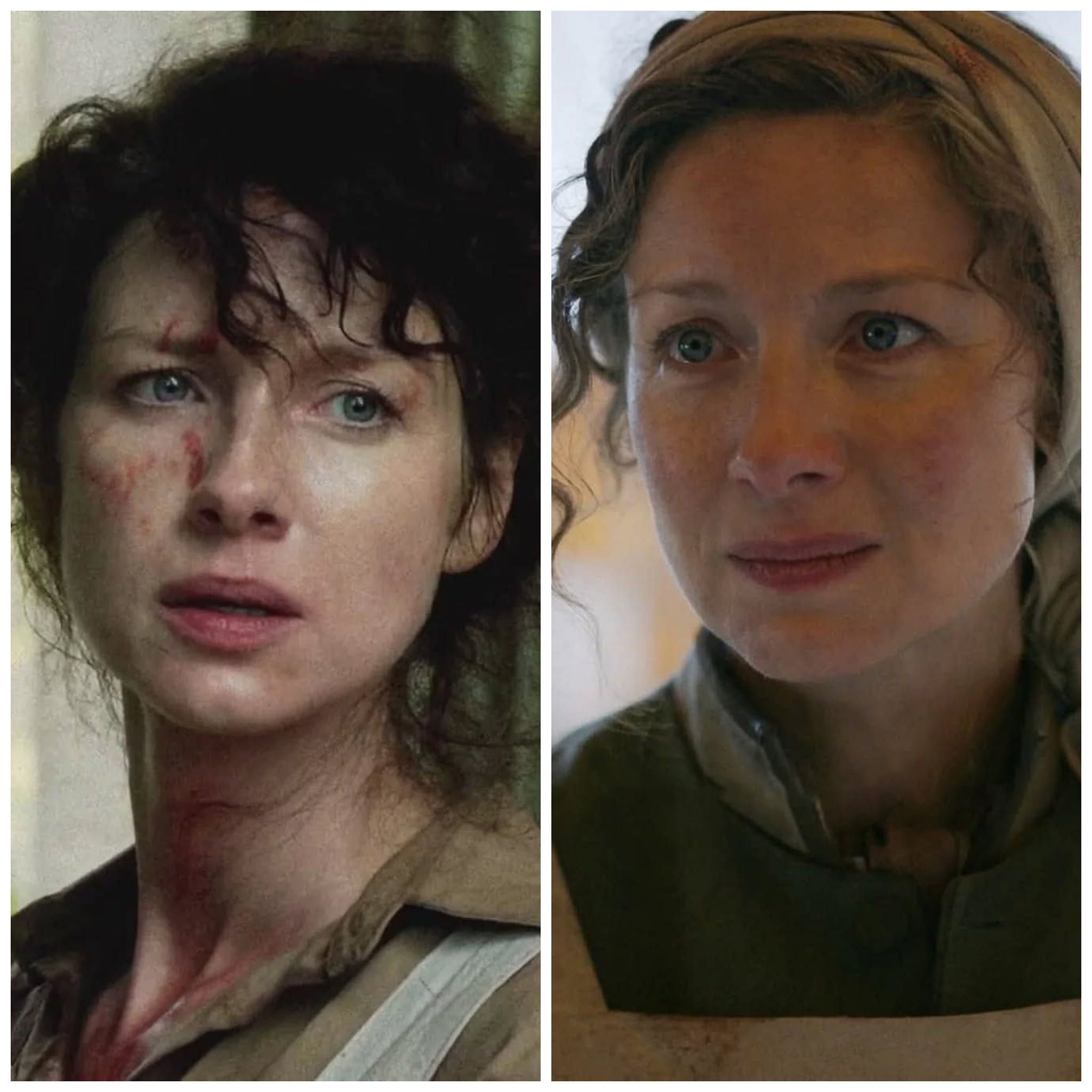Outlander - Claire is a combat nurse and later a doctor, her work has ...