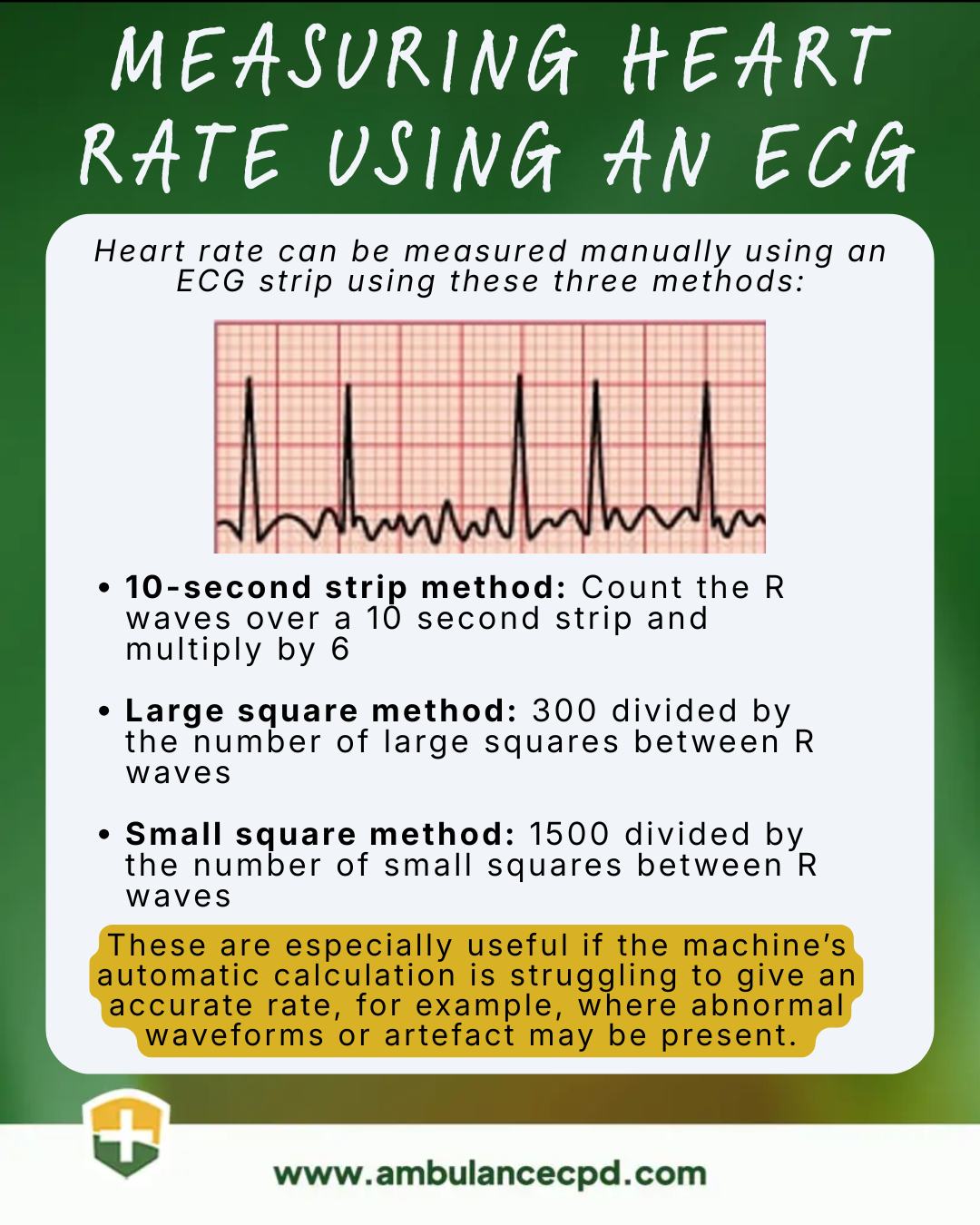 Ambulance - 📉 ECG series 5 – Measuring heart rate using an ECG ♥️ ...