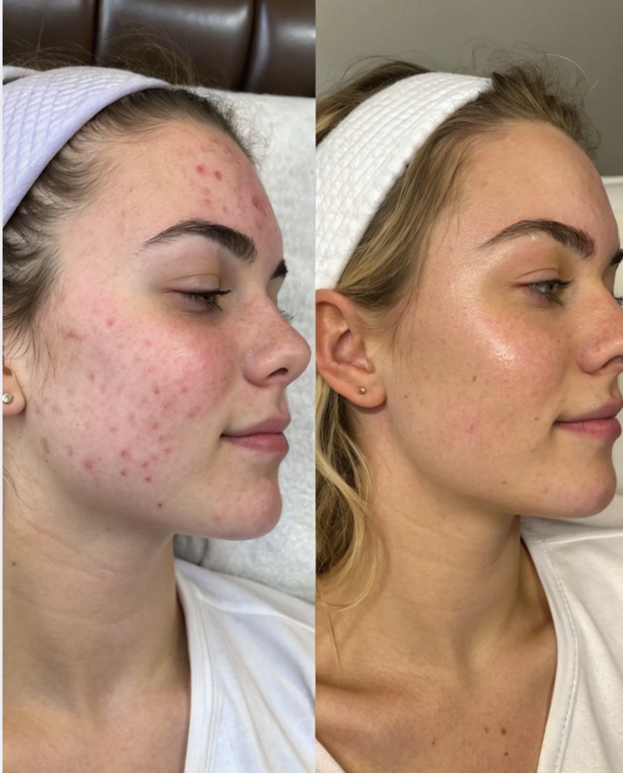 Meet the “pretty peptide” everyone is talking about… GHK-Cu ✨ One of the most exciting ingredients in regenerative aesthetics and skincare, GHK-Cu (copper peptide) is loved for its ability to support healthier