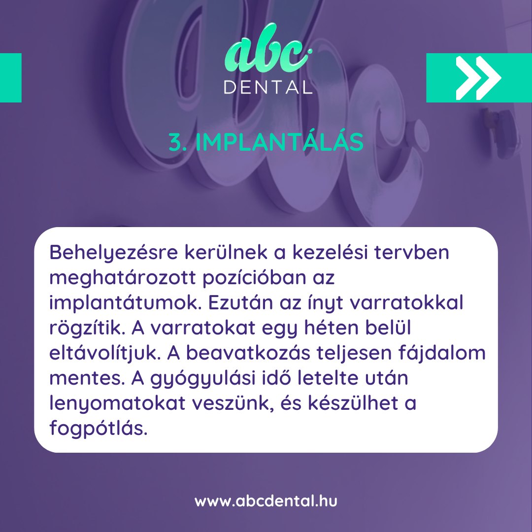 Abc Dental fogászat | Budapest