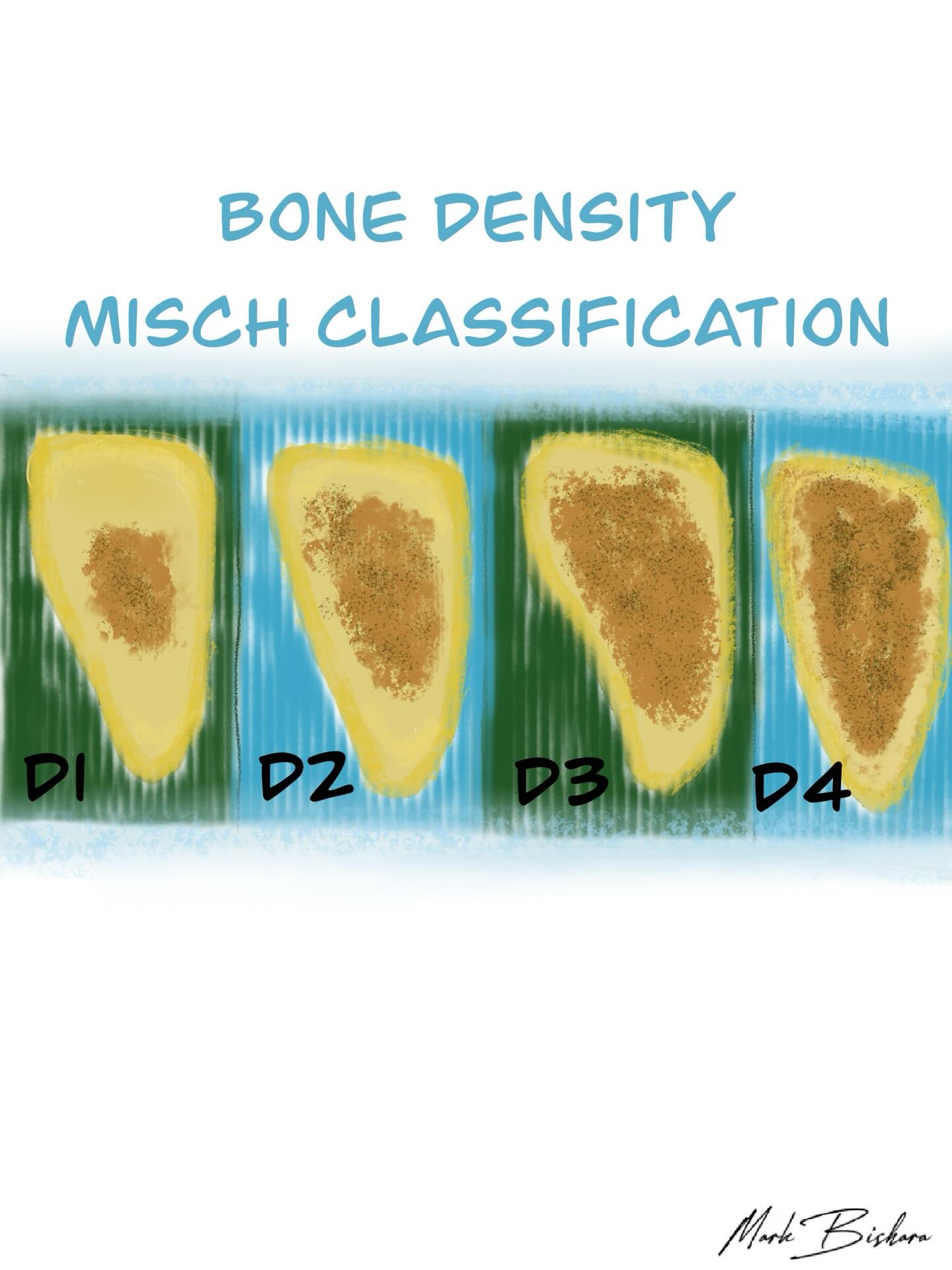 Canadian Implant Dentistry Network | Whitby ON