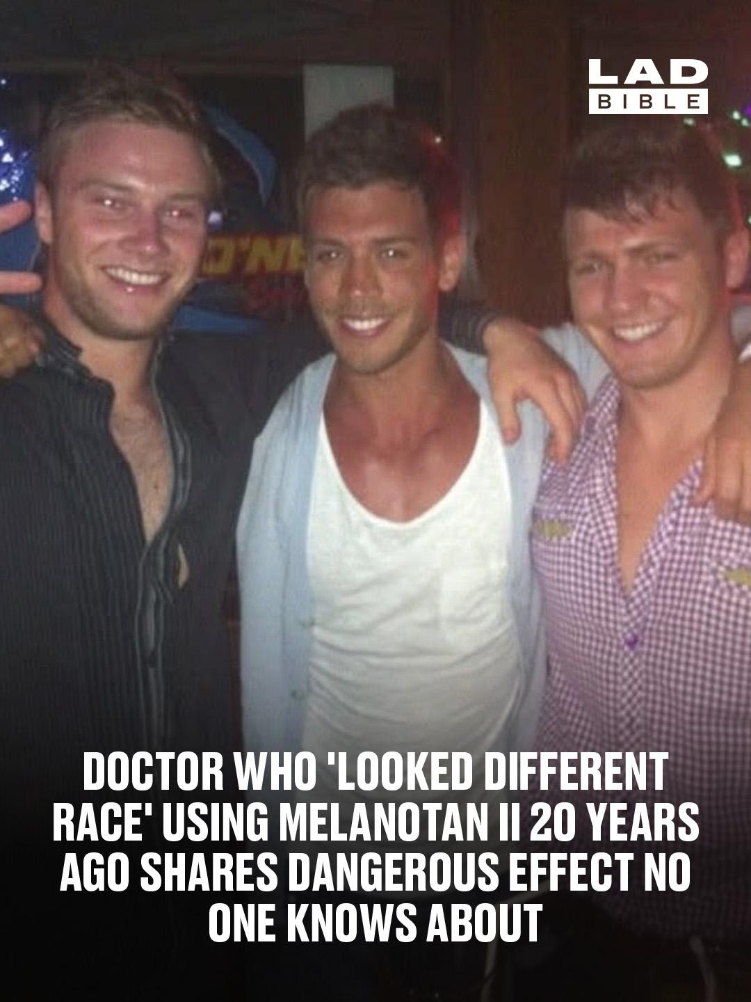 melanotan 2 before and after Seven Days Of , Only about 4 hours of sun exposure this week. , I feel as though my face has gotten the best results so far. , Hoping the sun actually comes out this week! , Have my Doctor who 'looked different race'