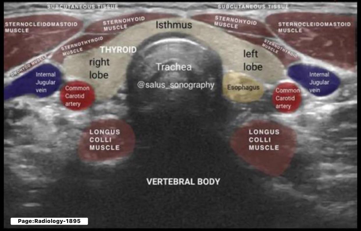 Radiology - Anatomy Ultrasound | Facebook