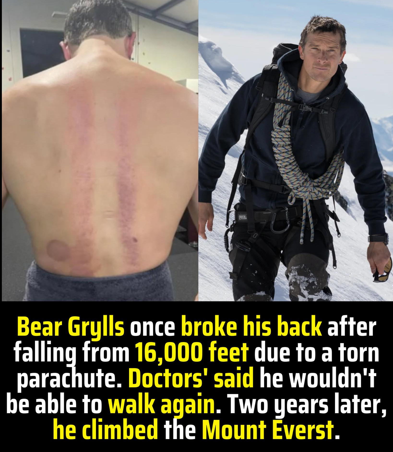 Some - 💥 From Broken Back to the Top of the World 💥 At 21, Bear Grylls ...