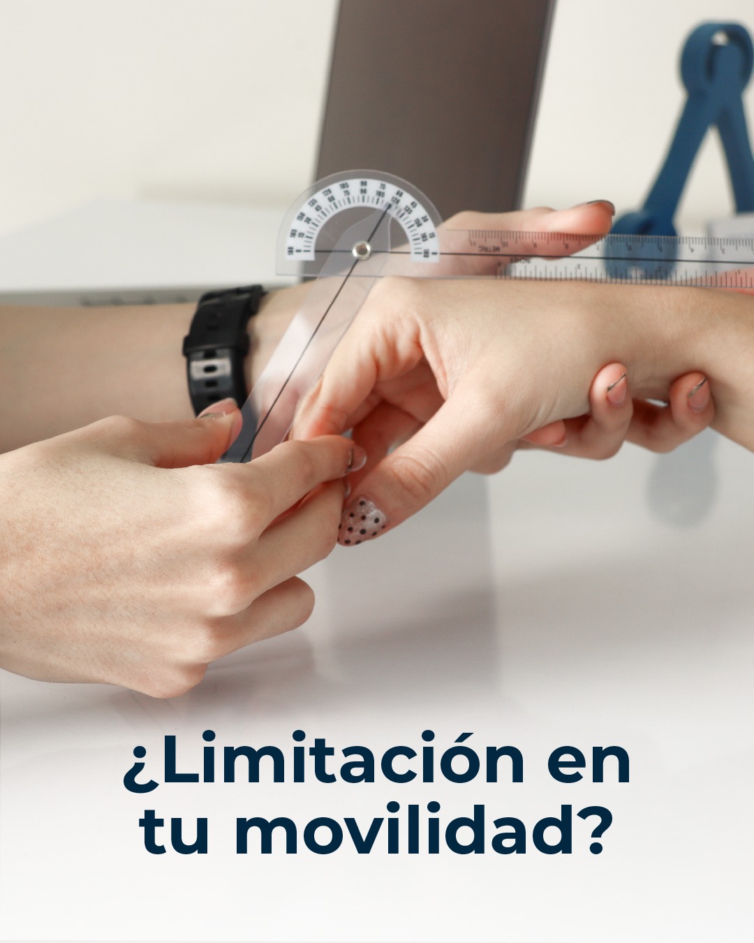 activa-la-rigidez-en-la-mano-es-un-s-ntoma-com-n-en-lesiones