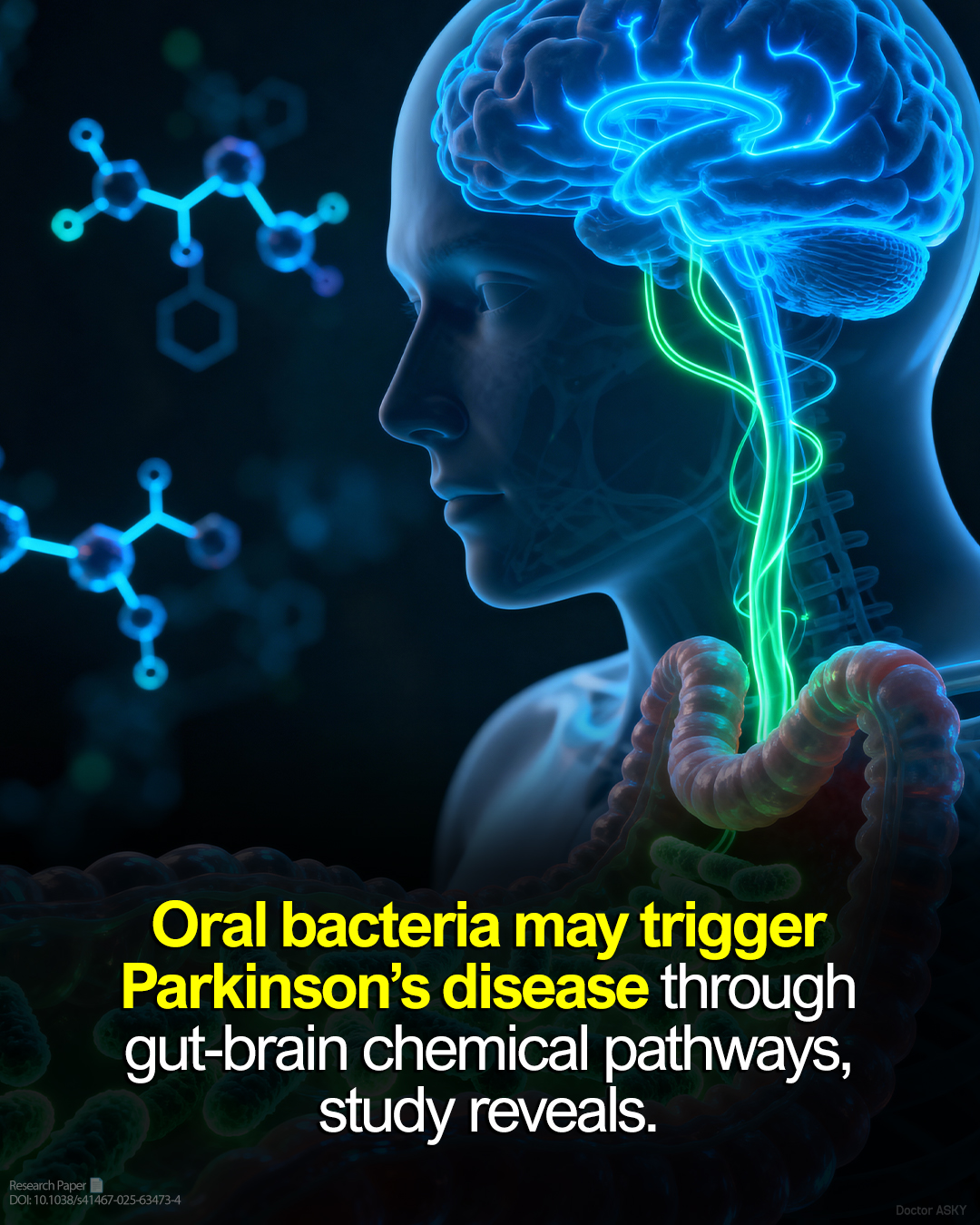 Doctor - Oral bacteria may trigger Parkinson’s disease through gut ...