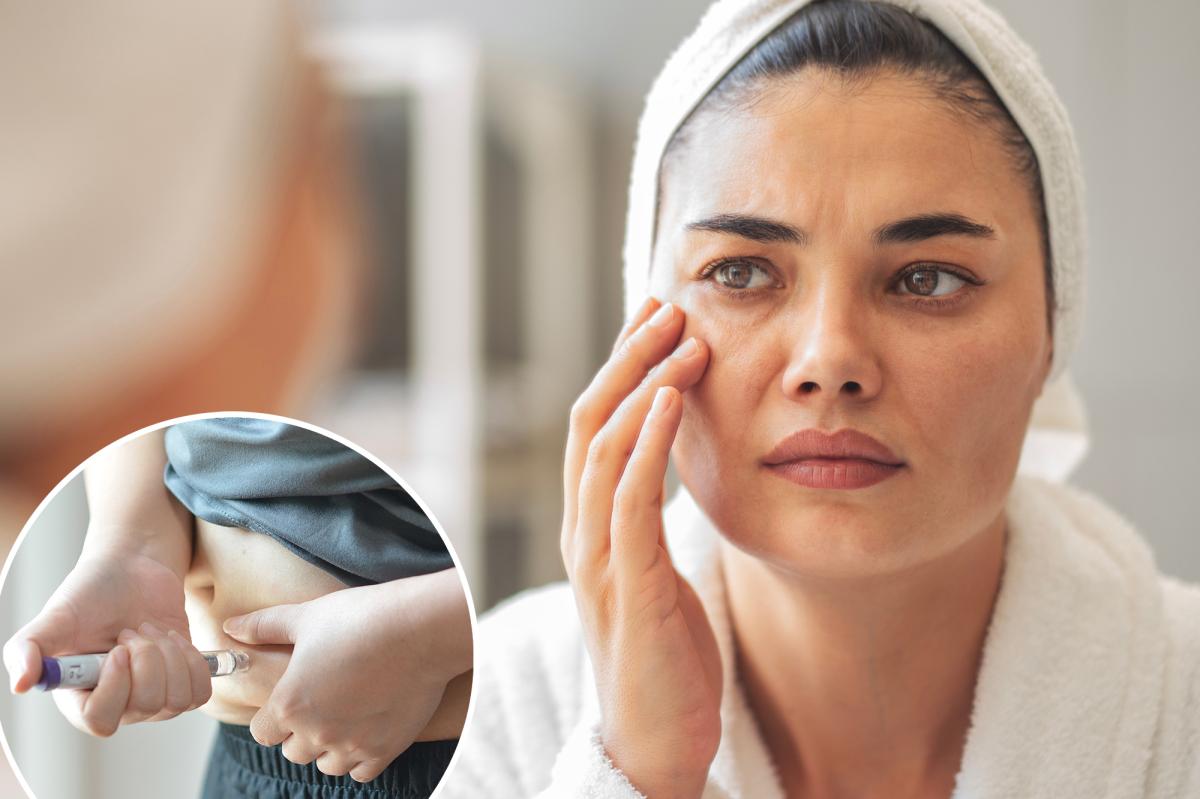 Temporal wasting': The GLP-1 side effect that makes patients 'look suddenly older'
