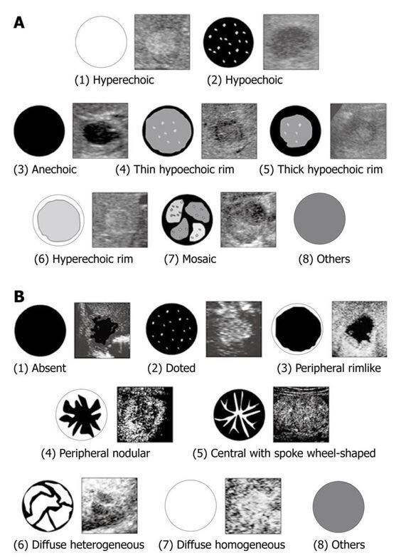 Radiology - Focal Lesions In The Liver | Facebook
