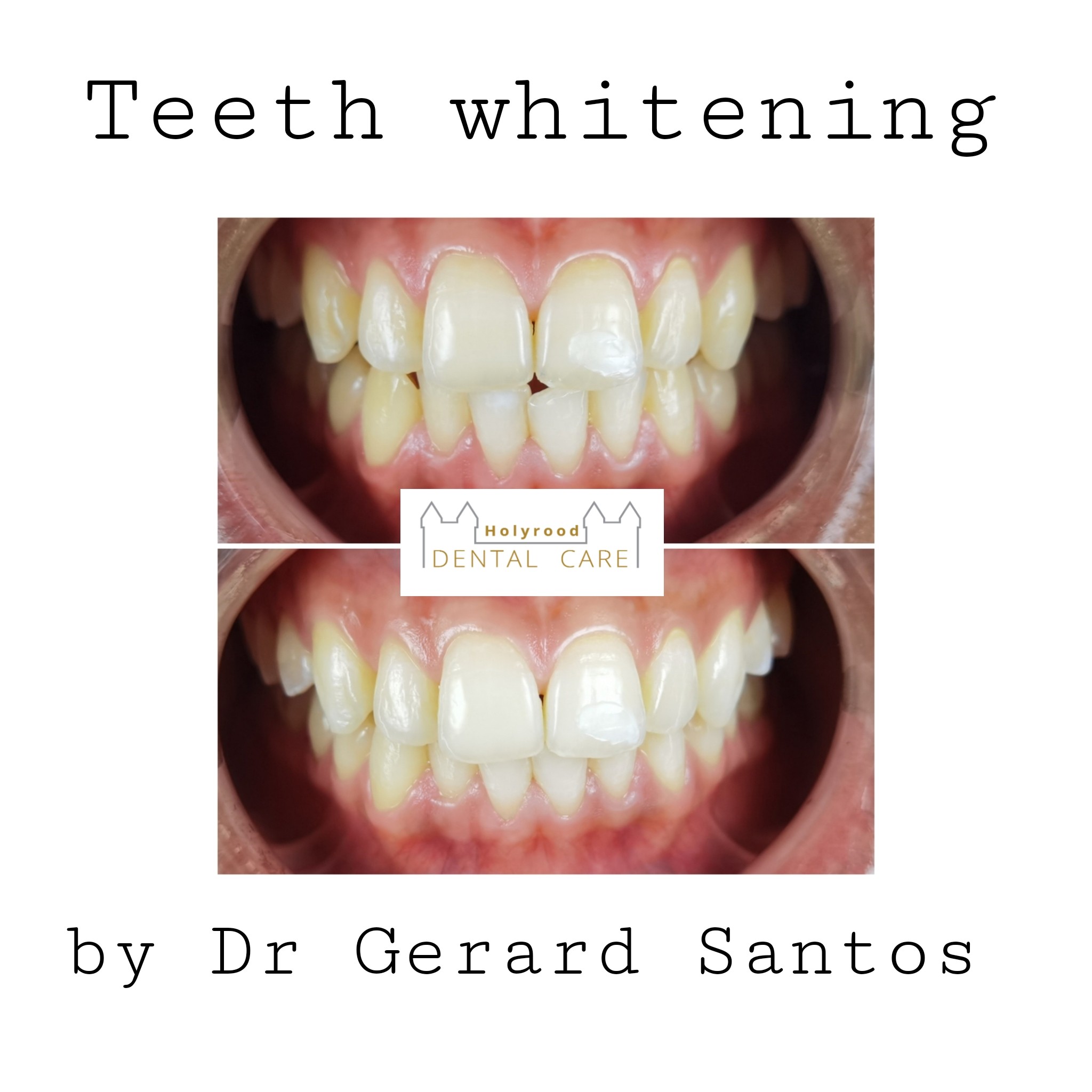 Holyrood - SMILE TRANSFORMATION ALERT! Check out these stunning before ...