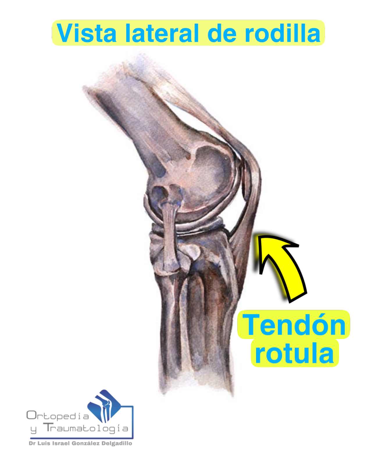 🦵 Tendinitis rotuliana: cuando la... - Dr Israel González | Facebook