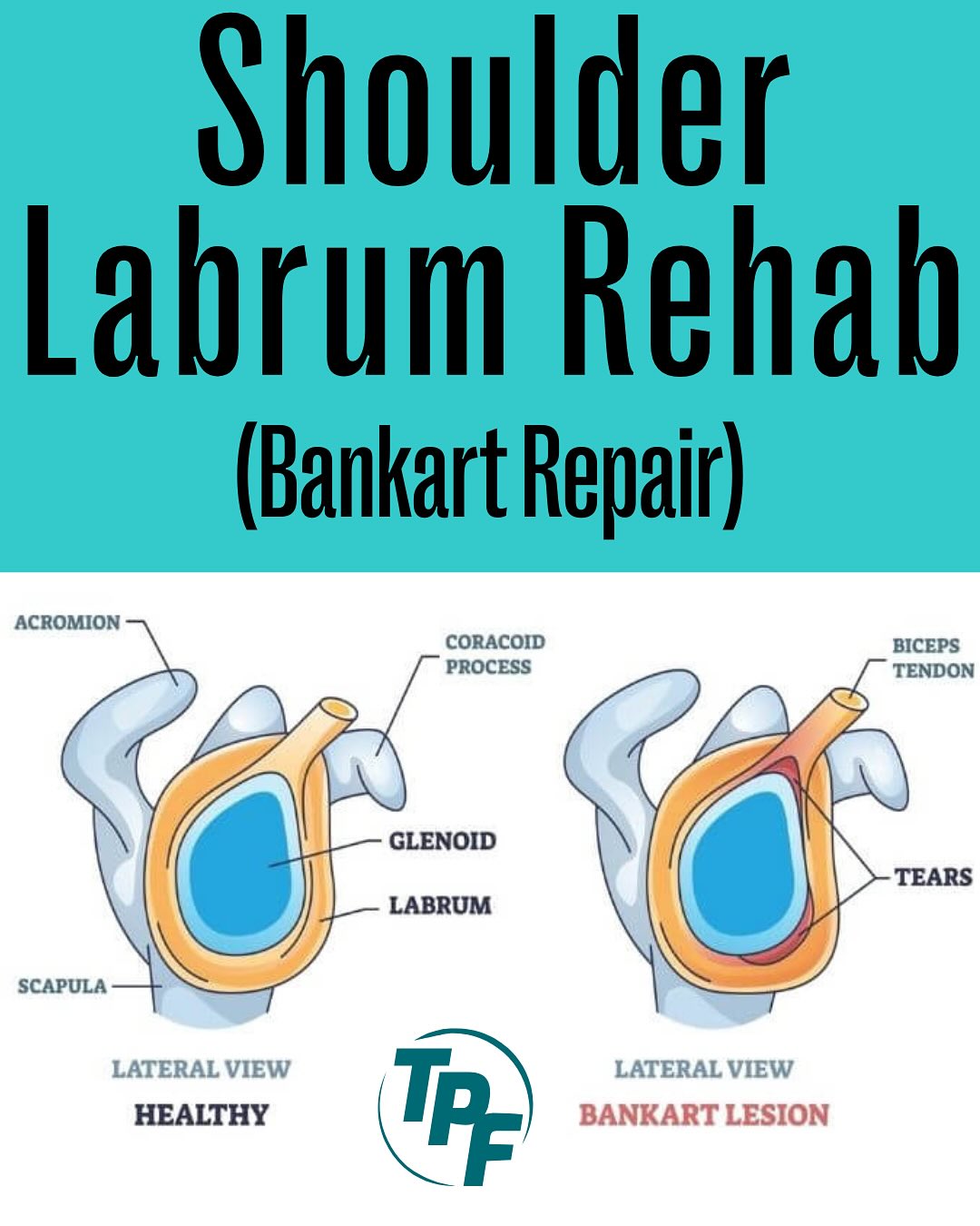 The Physio Fix - Shoulder injury? Want an entire program... | Facebook