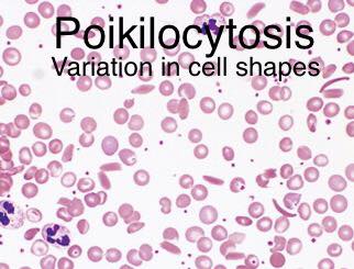Anisocytosis Medical Laboratory Technology Facebook