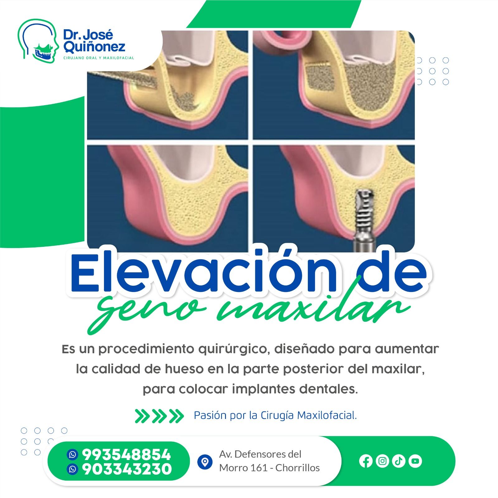 Dr. José Quiñonez - Cirujano Maxilofacial | Lima