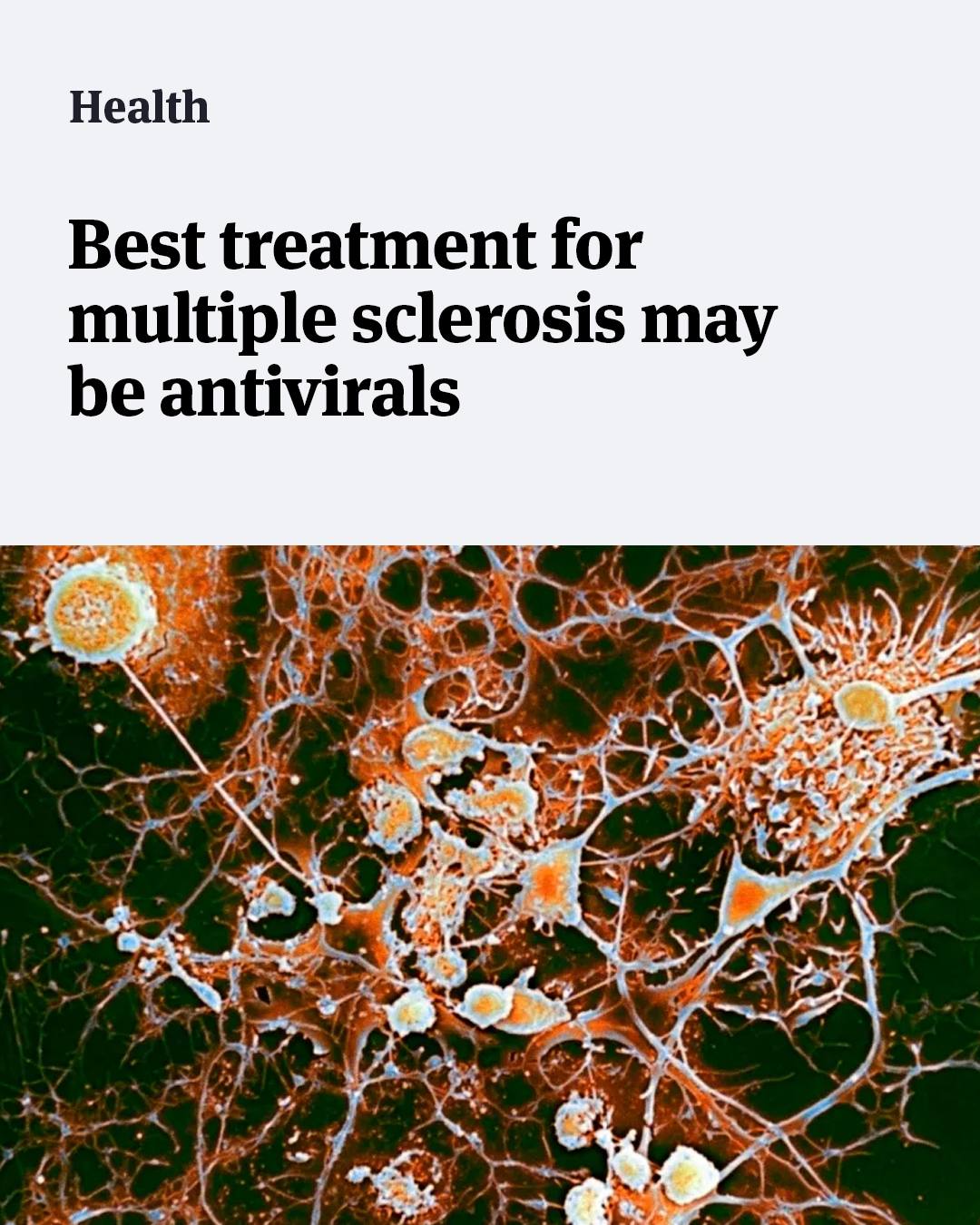 glutathione cycle reddit The best way of treating the autoimmune condition multiple sclerosis seems to be through anti-virals that target the Epstein-Barr virus, the same pathogen behind glandular fever, or mononucleosis ⚡ NAD+ vs Glutathione: Dietary Supplement BPC-157 Therapy Program:BPC Capsules Therapy