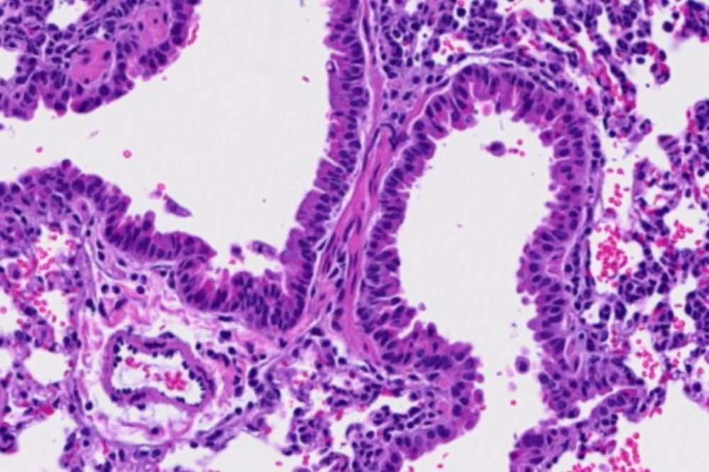 Low levels of the amino acid arginine are associated with a number of diseases, including #coloncancer. Now, Sohail Tavazoie's lab at Rockefeller has discovered that an arginine-deficient diet also impacts the #immunesystem