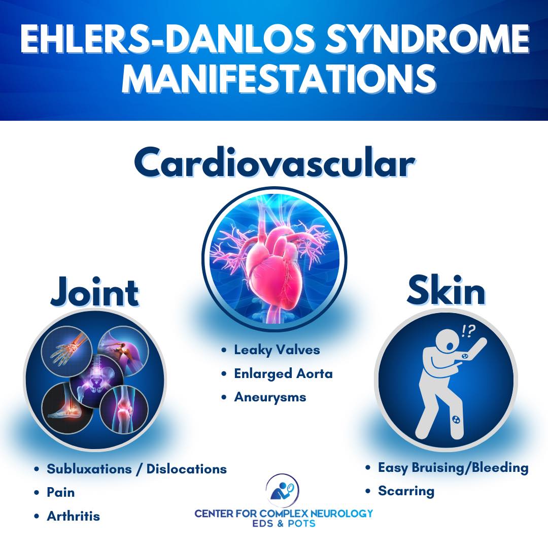 Center - 🌟 Living with Ehlers-Danlos Syndrome (EDS): It’s more than ...