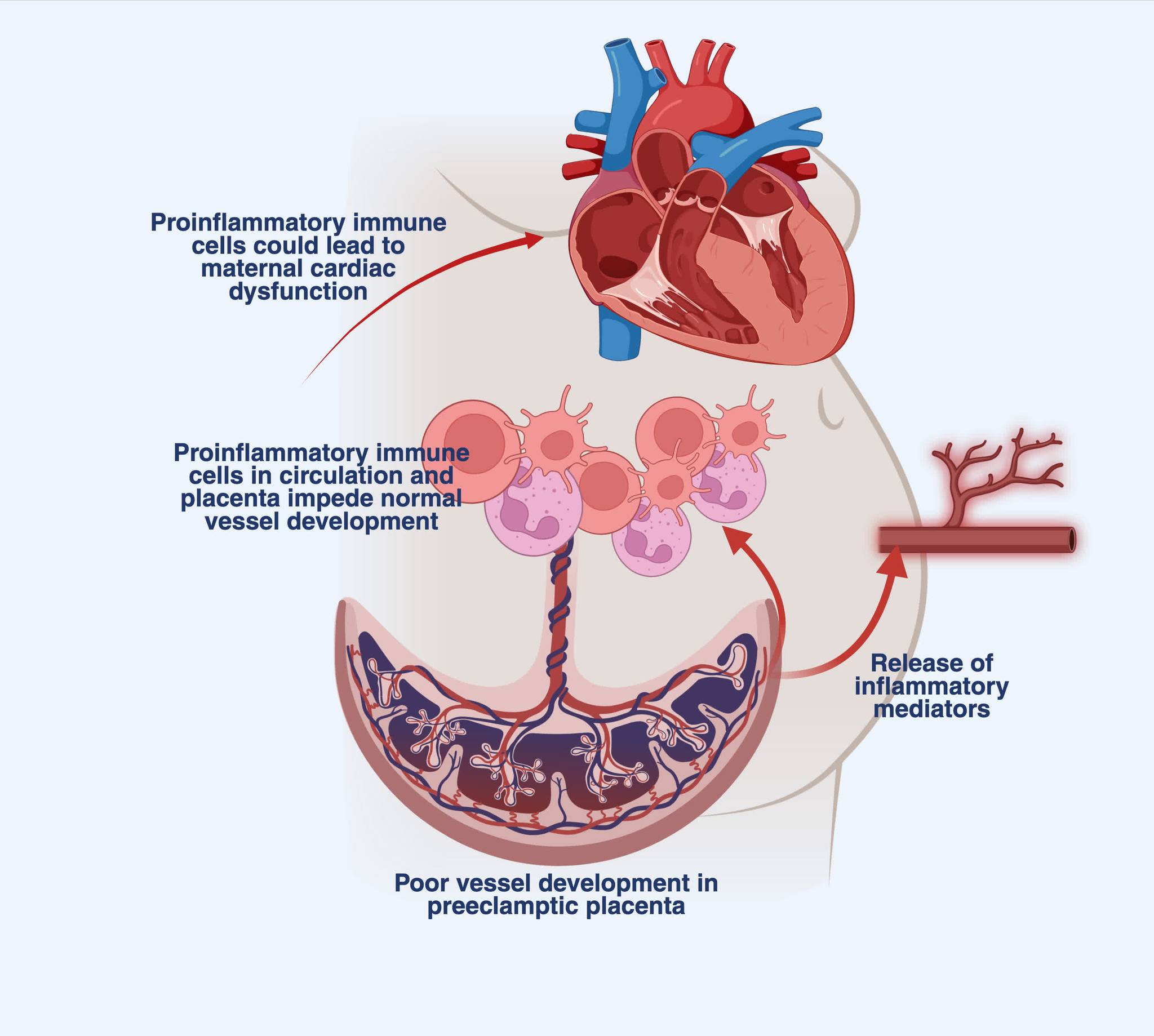 ATVB - Christensen et al (Nadkarni lab, @SciSuchita))... | Facebook