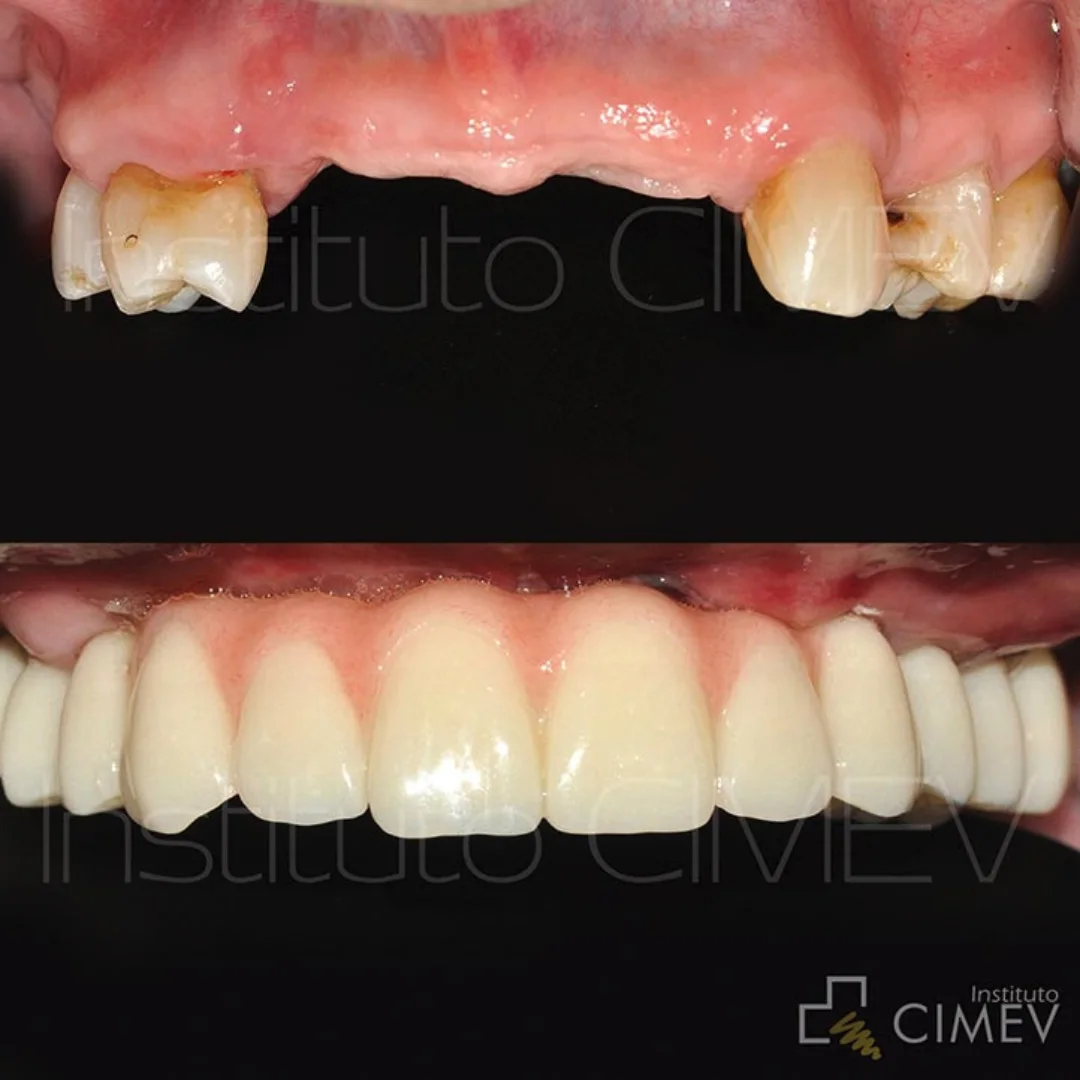 Instituto - Hoy os presentamos el caso de una paciente periodontal cuya ...