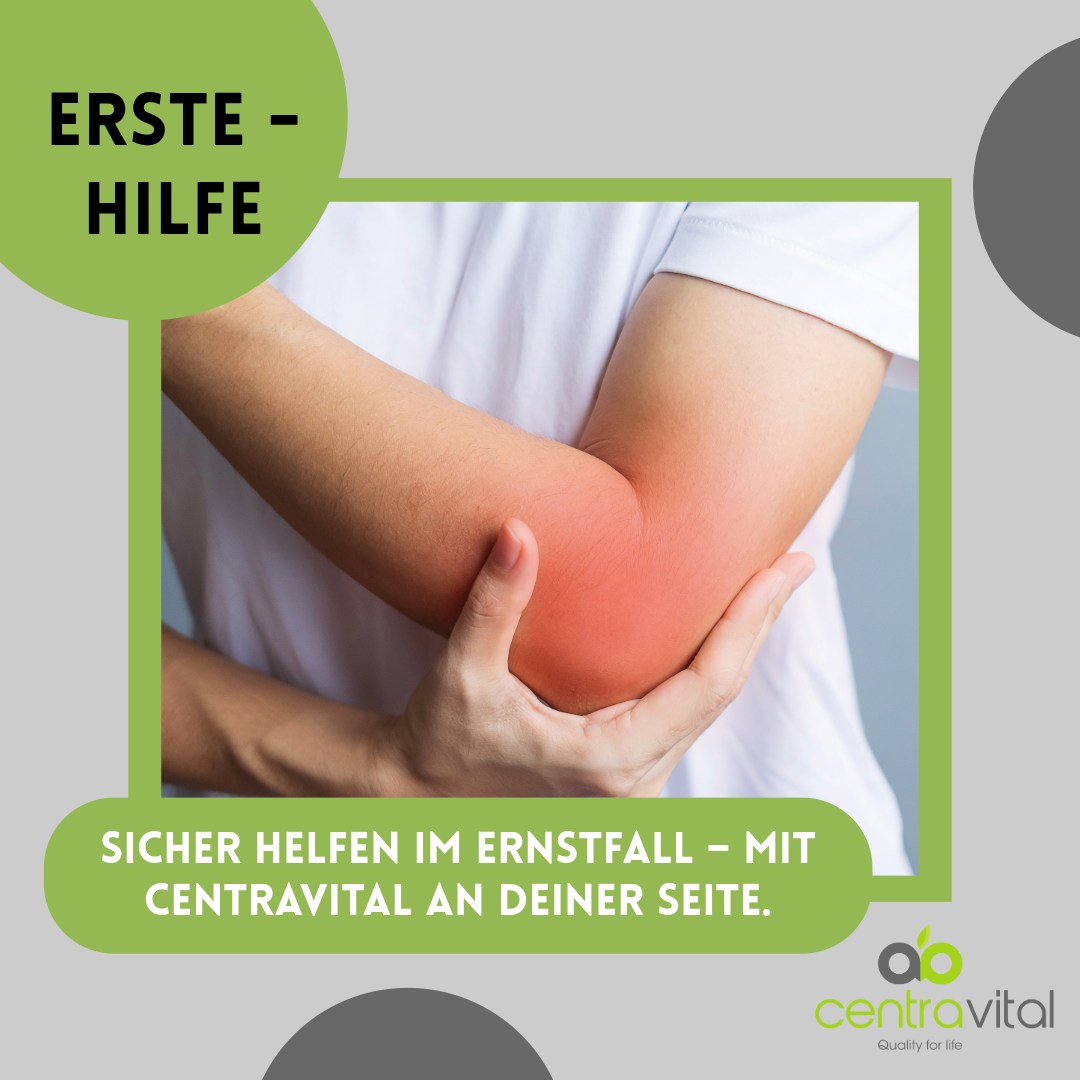 Centravital - 🩹 Verstauchung oder Prellung? So erkennen... | Facebook