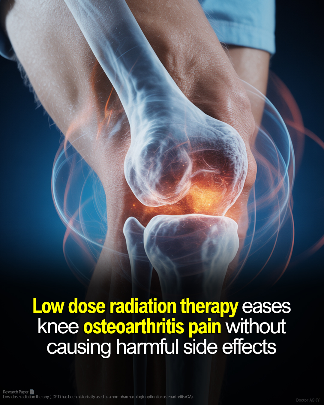 Doctor - Low dose radiation therapy eases knee osteoarthritis pain ...