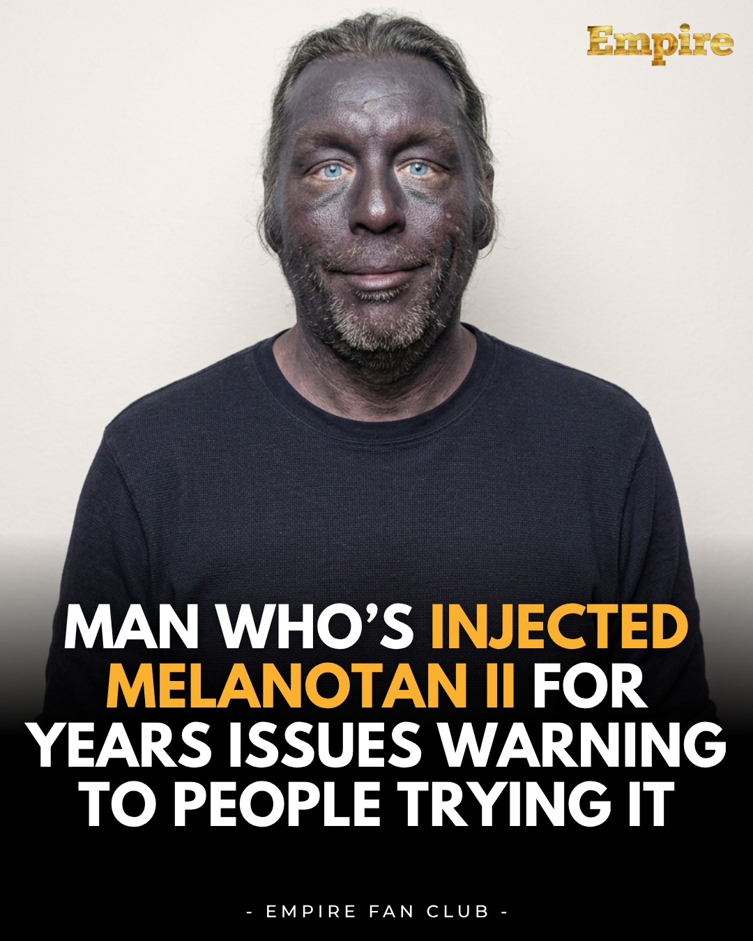 melanotan permanent 11 nasal spray is Melanotan II spray: a possible risk factor for oral mucosal malignant melanoma? You Should Avoid Using Nasal  Tanning Peptides: How Melanotan Led