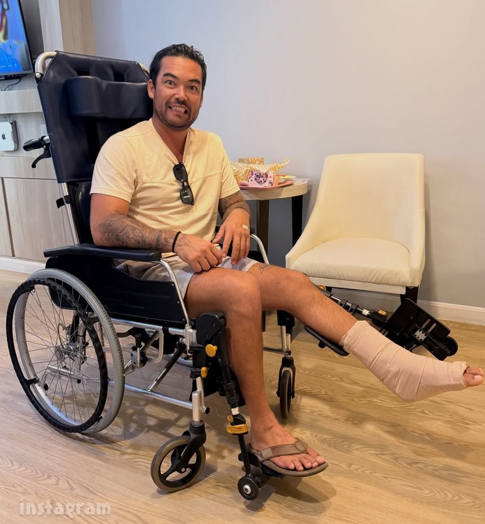 Starcasm - Below Deck Sailing Yacht Colin McRae injury his Achilles ...
