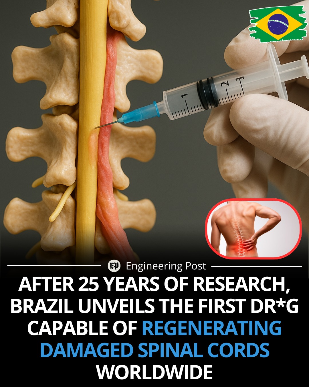 Engineering - Brazilian scientists have achieved a historic medical ...