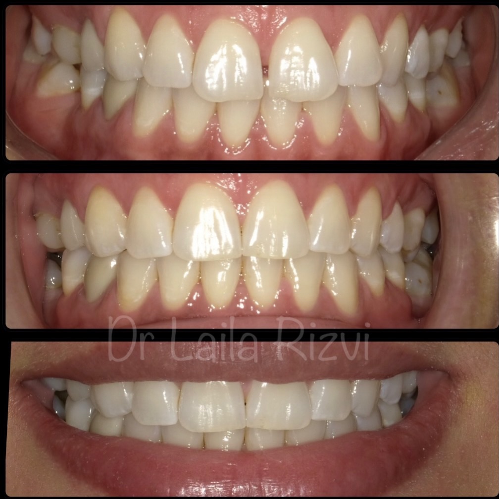 My Dental Care Center - Dr. Laila Rizvi | Orlando FL