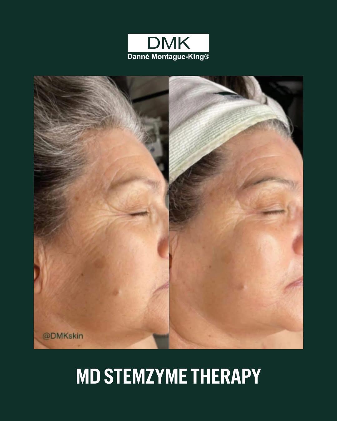 This impressive... - Body Bliss Medi Spa & Skin Clinic | Facebook