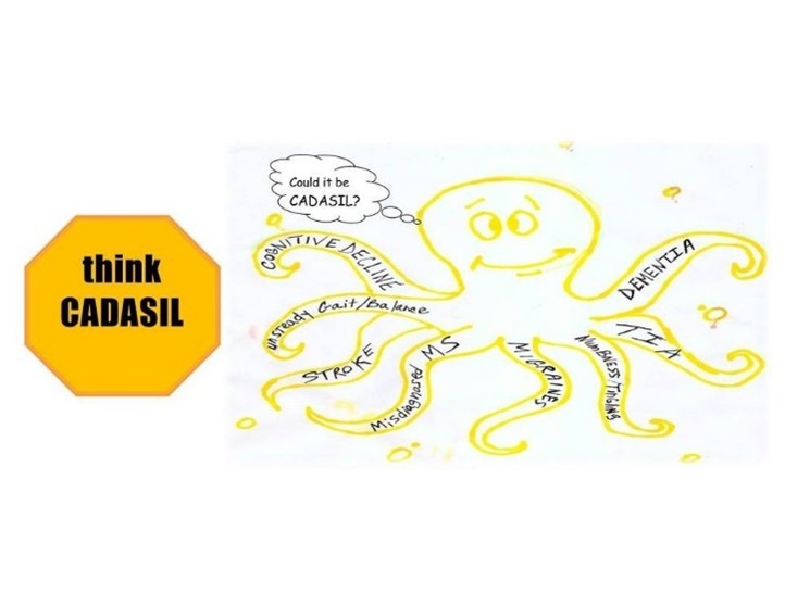 Third Annual CADASIL Awareness Fundraising Raffle
