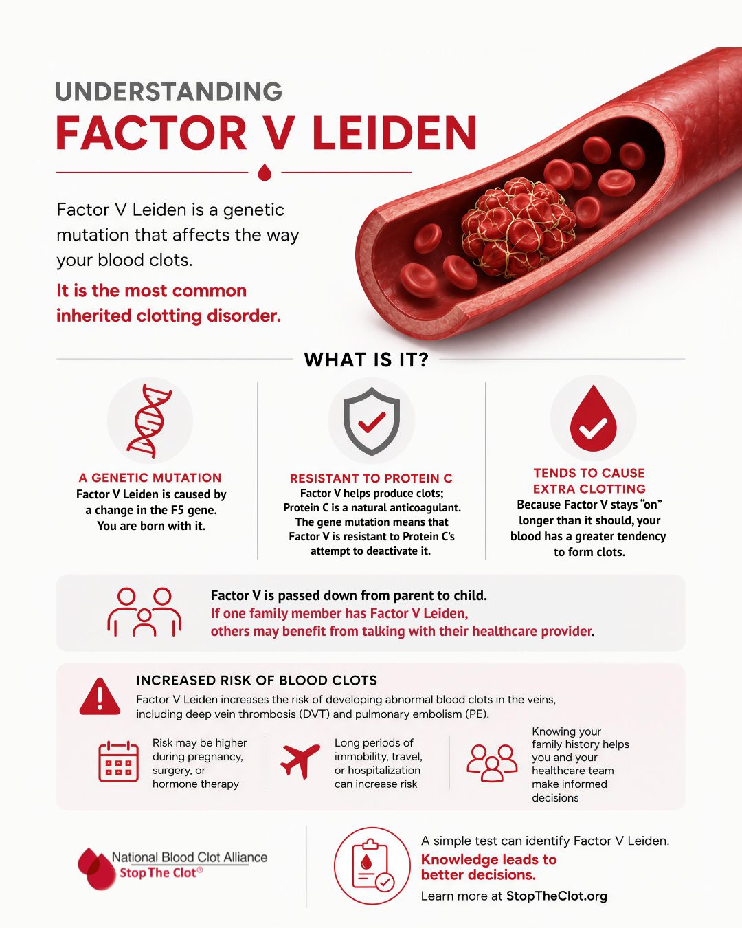 Factor V Leiden … increases clotting ability Factor V Leiden** thrombophilia is an inherited disorder of blood clotting. **Factor V Leiden** is the name of a specific gene mutation that results in