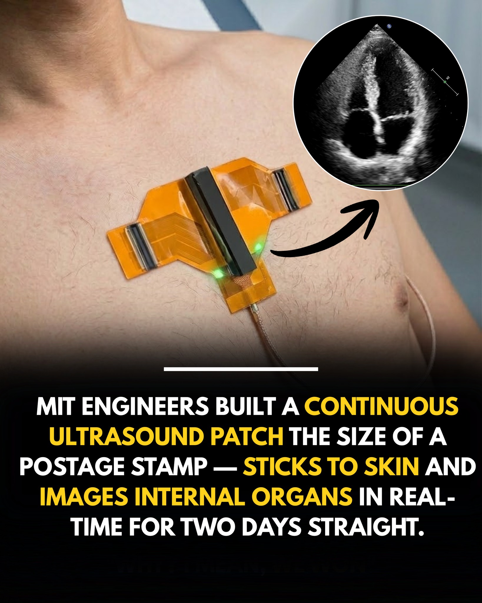 MIT engineers led by Dr. Xuanhe Zhao have developed a