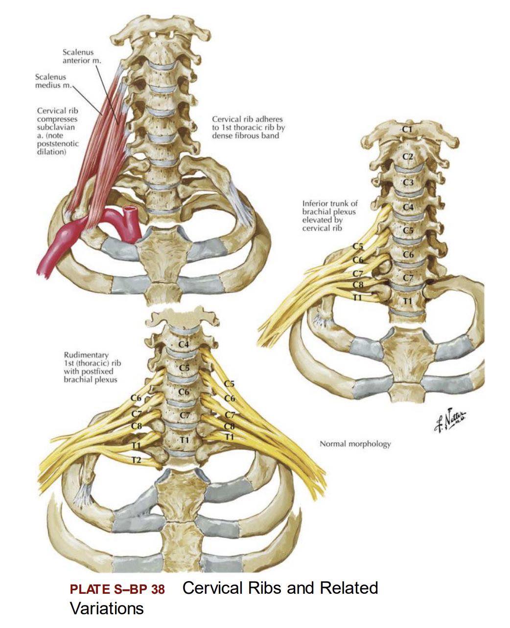 Dr. Muhammed - Cervical Ribs and Related Variation #fblifestyle | Facebook