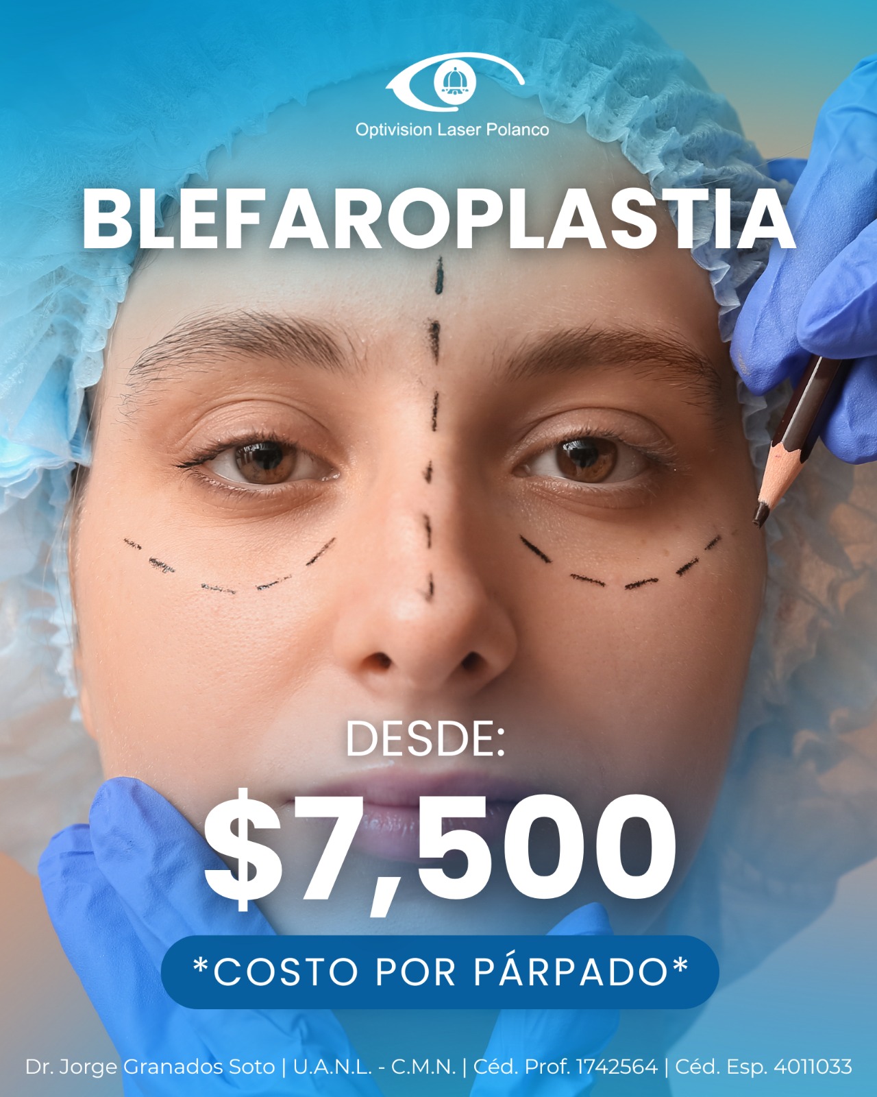 Operación - 👁️ Blefaroplastia Dale a tu mirada un aspecto más fresco ...